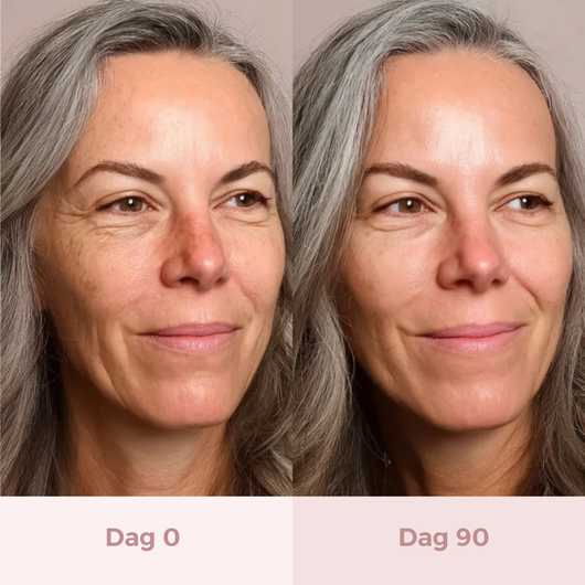 VitalLift™ LED Gezichtsmasker