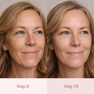 VitalLift™ LED Gezichtsmasker