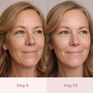 VitalLift™ LED Gezichtsmasker