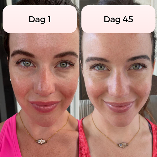 7-in-1 LED gezichtsmasker